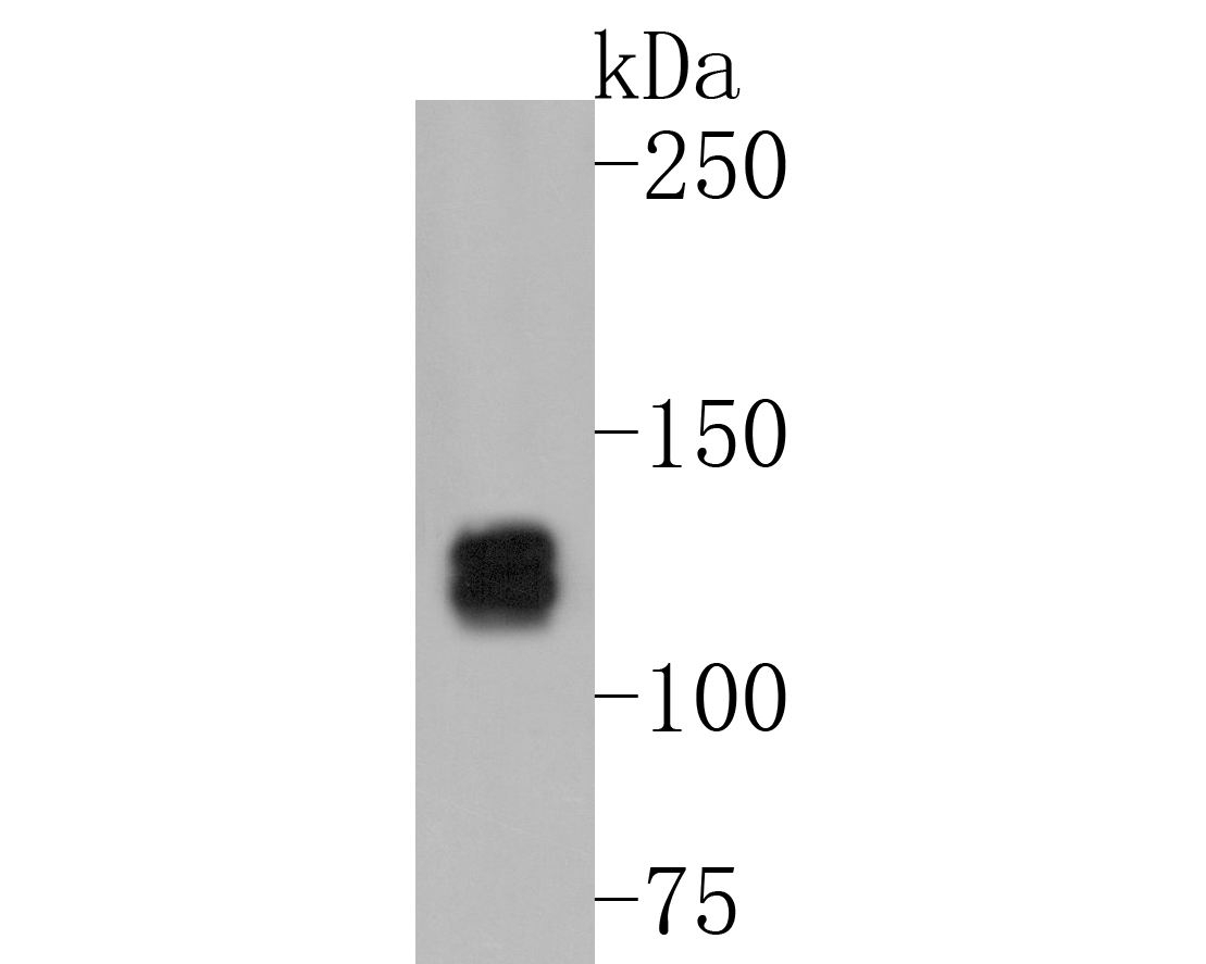 Western blot analysis of Myosin light chain kinase on human lung tissue lysates. Proteins were transferred to a PVDF membrane and blocked with 5% BSA in PBS for 1 hour at room temperature. The primary antibody (ET1608-68, 1/500) was used in 5% BSA at room temperature for 2 hours. Goat Anti-Rabbit IgG - HRP Secondary Antibody (HA1001) at 1:5,000 dilution was used for 1 hour at room temperature.