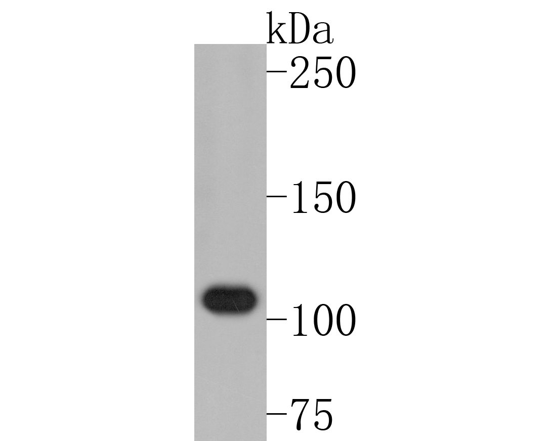 Western blot analysis of Myosin light chain kinase on rat lung tissue lysates. Proteins were transferred to a PVDF membrane and blocked with 5% BSA in PBS for 1 hour at room temperature. The primary antibody (ET1608-68, 1/500) was used in 5% BSA at room temperature for 2 hours. Goat Anti-Rabbit IgG - HRP Secondary Antibody (HA1001) at 1:5,000 dilution was used for 1 hour at room temperature.