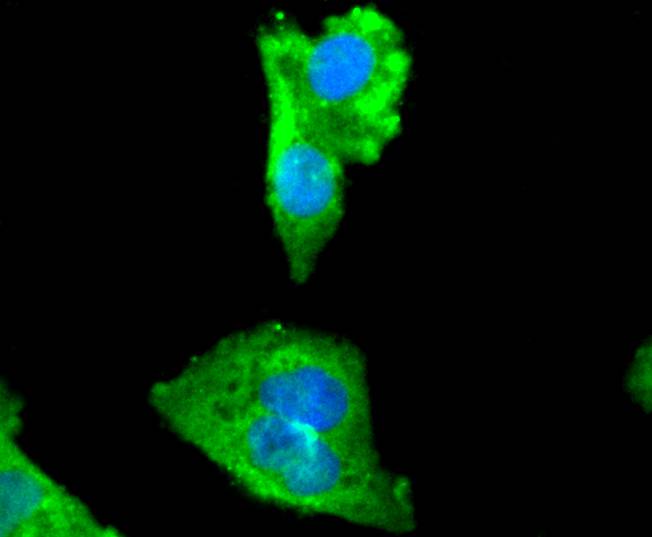 ICC staining of Myosin light chain kinase in Hela cells (green). Formalin fixed cells were permeabilized with 0.1% Triton X-100 in TBS for 10 minutes at room temperature and blocked with 1% Blocker BSA for 15 minutes at room temperature. Cells were probed with the primary antibody (ET1608-68, 1/50) for 1 hour at room temperature, washed with PBS. Alexa Fluor®488 Goat anti-Rabbit IgG was used as the secondary antibody at 1/1,000 dilution. The nuclear counter stain is DAPI (blue).