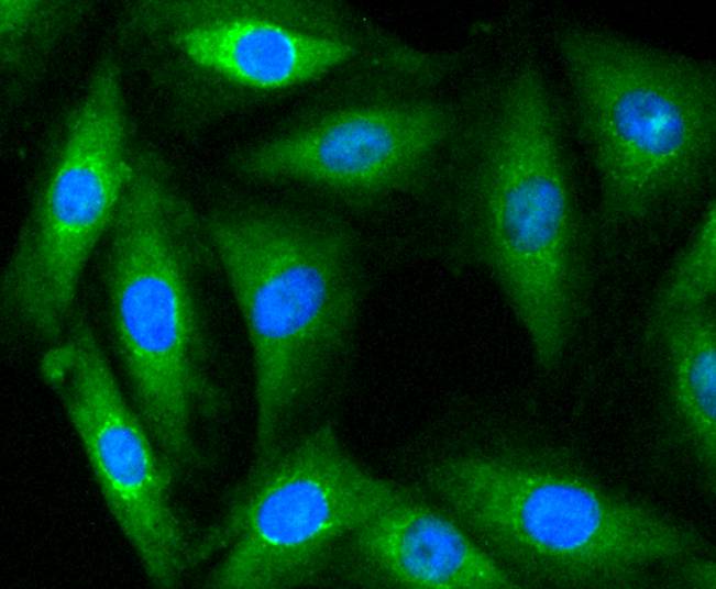 ICC staining of Myosin light chain kinase in L6 cells (green). Formalin fixed cells were permeabilized with 0.1% Triton X-100 in TBS for 10 minutes at room temperature and blocked with 1% Blocker BSA for 15 minutes at room temperature. Cells were probed with the primary antibody (ET1608-68, 1/50) for 1 hour at room temperature, washed with PBS. Alexa Fluor®488 Goat anti-Rabbit IgG was used as the secondary antibody at 1/1,000 dilution. The nuclear counter stain is DAPI (blue).