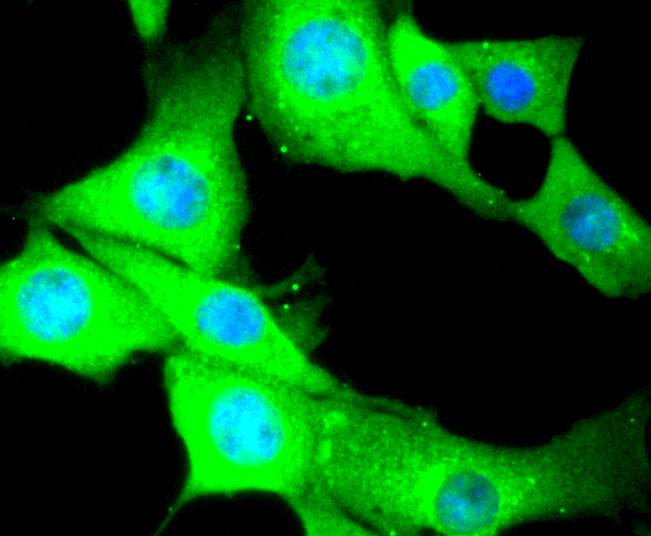 ICC staining of Myosin light chain kinase in NIH/3T3 cells (green). Formalin fixed cells were permeabilized with 0.1% Triton X-100 in TBS for 10 minutes at room temperature and blocked with 1% Blocker BSA for 15 minutes at room temperature. Cells were probed with the primary antibody (ET1608-68, 1/50) for 1 hour at room temperature, washed with PBS. Alexa Fluor®488 Goat anti-Rabbit IgG was used as the secondary antibody at 1/1,000 dilution. The nuclear counter stain is DAPI (blue).