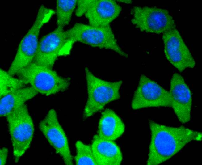 ICC staining of Myosin light chain kinase in SH-SY5Y cells (green). Formalin fixed cells were permeabilized with 0.1% Triton X-100 in TBS for 10 minutes at room temperature and blocked with 1% Blocker BSA for 15 minutes at room temperature. Cells were probed with the primary antibody (ET1608-68, 1/50) for 1 hour at room temperature, washed with PBS. Alexa Fluor®488 Goat anti-Rabbit IgG was used as the secondary antibody at 1/1,000 dilution. The nuclear counter stain is DAPI (blue).