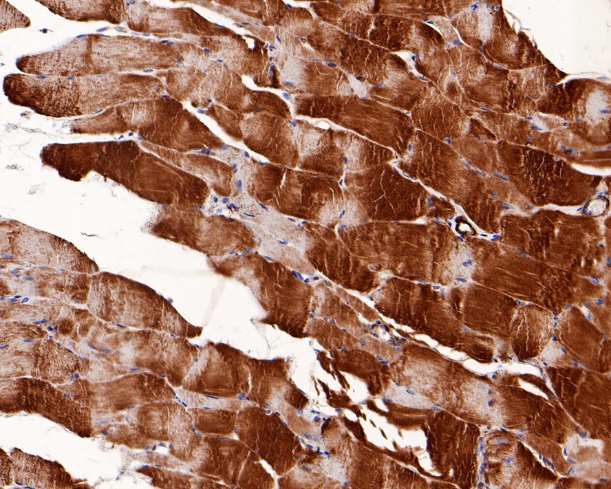 Immunohistochemical analysis of paraffin-embedded rat smooth muscle tissue with Rabbit anti-Myosin light chain kinase antibody (ET1608-68) at 1/800 dilution.<br />
<br />
The section was pre-treated using heat mediated antigen retrieval with Tris-EDTA buffer (pH 9.0) for 20 minutes. The tissues were blocked in 1% BSA for 20 minutes at room temperature, washed with ddH2O and PBS, and then probed with the primary antibody (ET1608-68) at 1/800 dilution for 1 hour at room temperature. The detection was performed using an HRP conjugated compact polymer system. DAB was used as the chromogen. Tissues were counterstained with hematoxylin and mounted with DPX.