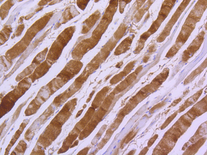 Immunohistochemical analysis of paraffin-embedded mouse smooth muscle tissue using anti-Myosin light chain kinase antibody. The section was pre-treated using heat mediated antigen retrieval with Tris-EDTA buffer (pH 8.0-8.4) for 20 minutes.The tissues were blocked in 5% BSA for 30 minutes at room temperature, washed with ddH2O and PBS, and then probed with the primary antibody (ET1608-68, 1/50) for 30 minutes at room temperature. The detection was performed using an HRP conjugated compact polymer system. DAB was used as the chromogen. Tissues were counterstained with hematoxylin and mounted with DPX.