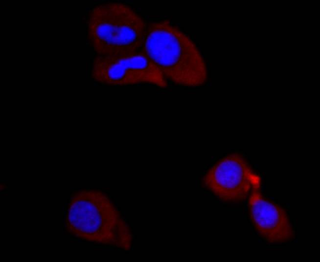 ICC staining of PI 3 Kinase p85 alpha in MCF-7 cells (red). Formalin fixed cells were permeabilized with 0.1% Triton X-100 in TBS for 10 minutes at room temperature and blocked with 1% Blocker BSA for 15 minutes at room temperature. Cells were probed with the primary antibody (ET1608-70, 1/50) for 1 hour at room temperature, washed with PBS. Alexa Fluor®594 Goat anti-Rabbit IgG was used as the secondary antibody at 1/1,000 dilution. The nuclear counter stain is DAPI (blue).