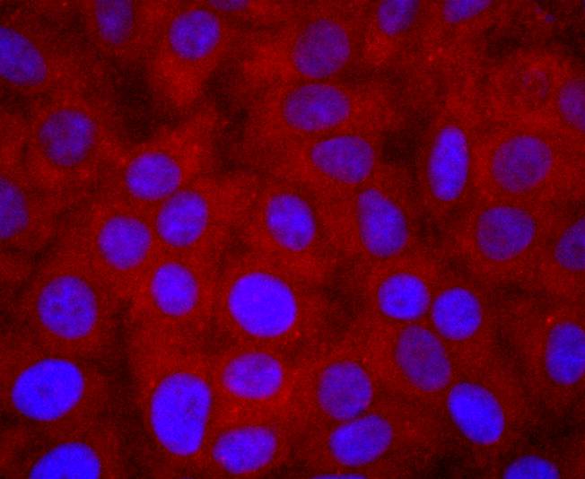 ICC staining of PI 3 Kinase p85 alpha in HepG2 cells (red). Formalin fixed cells were permeabilized with 0.1% Triton X-100 in TBS for 10 minutes at room temperature and blocked with 1% Blocker BSA for 15 minutes at room temperature. Cells were probed with the primary antibody (ET1608-70, 1/50) for 1 hour at room temperature, washed with PBS. Alexa Fluor®594 Goat anti-Rabbit IgG was used as the secondary antibody at 1/1,000 dilution. The nuclear counter stain is DAPI (blue).