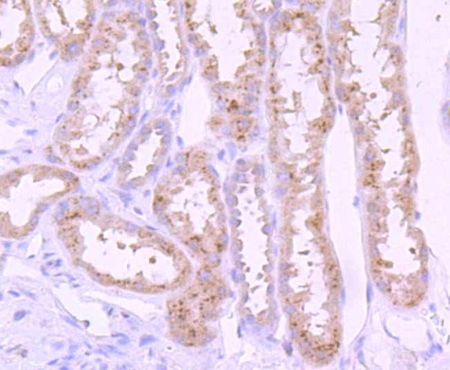 Immunohistochemical analysis of paraffin-embedded human kidney tissue using anti-PI 3 Kinase p85 alpha antibody. The section was pre-treated using heat mediated antigen retrieval with Tris-EDTA buffer (pH 8.0-8.4) for 20 minutes.The tissues were blocked in 5% BSA for 30 minutes at room temperature, washed with ddH2O and PBS, and then probed with the primary antibody (ET1608-70, 1/50) for 30 minutes at room temperature. The detection was performed using an HRP conjugated compact polymer system. DAB was used as the chromogen. Tissues were counterstained with hematoxylin and mounted with DPX.
