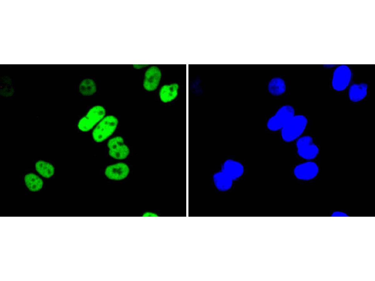 ICC staining of Histone H3(acetyl K56) in Hela cells (green). Formalin fixed cells were permeabilized with 0.1% Triton X-100 in TBS for 10 minutes at room temperature and blocked with 1% Blocker BSA for 15 minutes at room temperature. Cells were probed with the primary antibody (ET1608-9, 1/50) for 1 hour at room temperature, washed with PBS. Alexa Fluor®488 Goat anti-Rabbit IgG was used as the secondary antibody at 1/1,000 dilution. The nuclear counter stain is DAPI (blue).