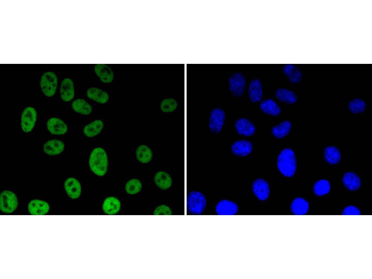 ICC staining of Histone H3(acetyl K56) in HepG2 cells (green). Formalin fixed cells were permeabilized with 0.1% Triton X-100 in TBS for 10 minutes at room temperature and blocked with 1% Blocker BSA for 15 minutes at room temperature. Cells were probed with the primary antibody (ET1608-9, 1/50) for 1 hour at room temperature, washed with PBS. Alexa Fluor®488 Goat anti-Rabbit IgG was used as the secondary antibody at 1/1,000 dilution. The nuclear counter stain is DAPI (blue).