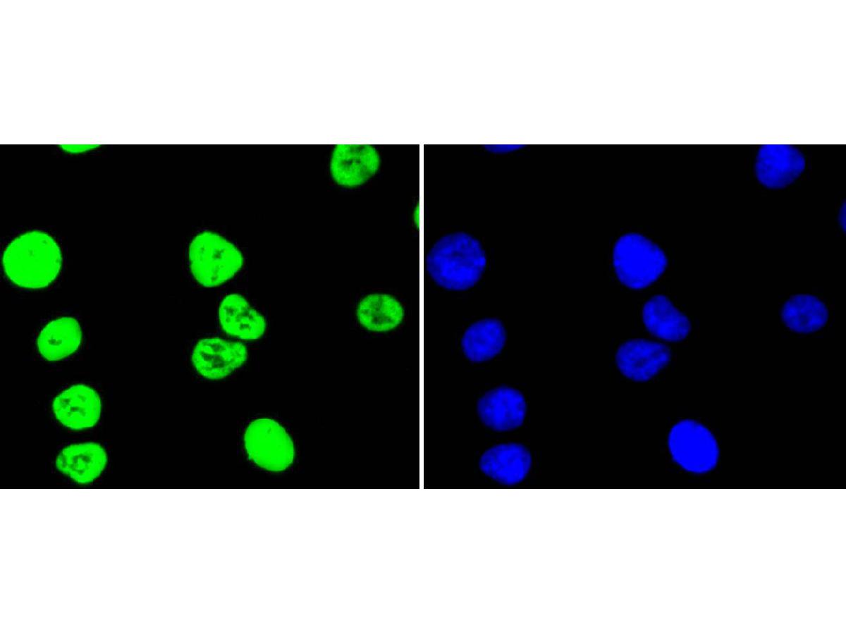ICC staining of Histone H3(acetyl K56) in A549 cells (green). Formalin fixed cells were permeabilized with 0.1% Triton X-100 in TBS for 10 minutes at room temperature and blocked with 1% Blocker BSA for 15 minutes at room temperature. Cells were probed with the primary antibody (ET1608-9, 1/50) for 1 hour at room temperature, washed with PBS. Alexa Fluor®488 Goat anti-Rabbit IgG was used as the secondary antibody at 1/1,000 dilution. The nuclear counter stain is DAPI (blue).