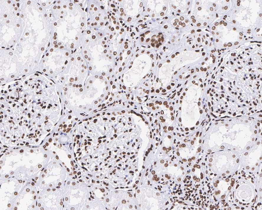 Immunohistochemical analysis of paraffin-embedded human kidney tissue with Rabbit anti-Histone H3(acetyl K56) antibody (ET1608-9) at 1/800 dilution.<br />
<br />
The section was pre-treated using heat mediated antigen retrieval with sodium citrate buffer (pH 6.0) for 2 minutes. The tissues were blocked in 1% BSA for 20 minutes at room temperature, washed with ddH2O and PBS, and then probed with the primary antibody (ET1608-9) at 1/800 dilution for 1 hour at room temperature. The detection was performed using an HRP conjugated compact polymer system. DAB was used as the chromogen. Tissues were counterstained with hematoxylin and mounted with DPX.