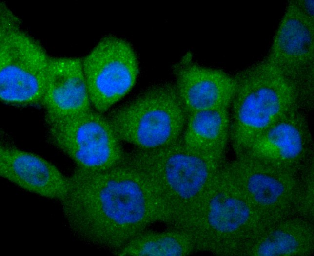 ICC staining of MCSF in A431 cells (green). Formalin fixed cells were permeabilized with 0.1% Triton X-100 in TBS for 10 minutes at room temperature and blocked with 1% Blocker BSA for 15 minutes at room temperature. Cells were probed with the primary antibody (ET1609-1, 1/50) for 1 hour at room temperature, washed with PBS. Alexa Fluor®488 Goat anti-Rabbit IgG was used as the secondary antibody at 1/1,000 dilution. The nuclear counter stain is DAPI (blue).