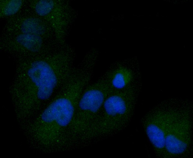 ICC staining of MCSF in Hela cells (green). Formalin fixed cells were permeabilized with 0.1% Triton X-100 in TBS for 10 minutes at room temperature and blocked with 1% Blocker BSA for 15 minutes at room temperature. Cells were probed with the primary antibody (ET1609-1, 1/50) for 1 hour at room temperature, washed with PBS. Alexa Fluor®488 Goat anti-Rabbit IgG was used as the secondary antibody at 1/1,000 dilution. The nuclear counter stain is DAPI (blue).