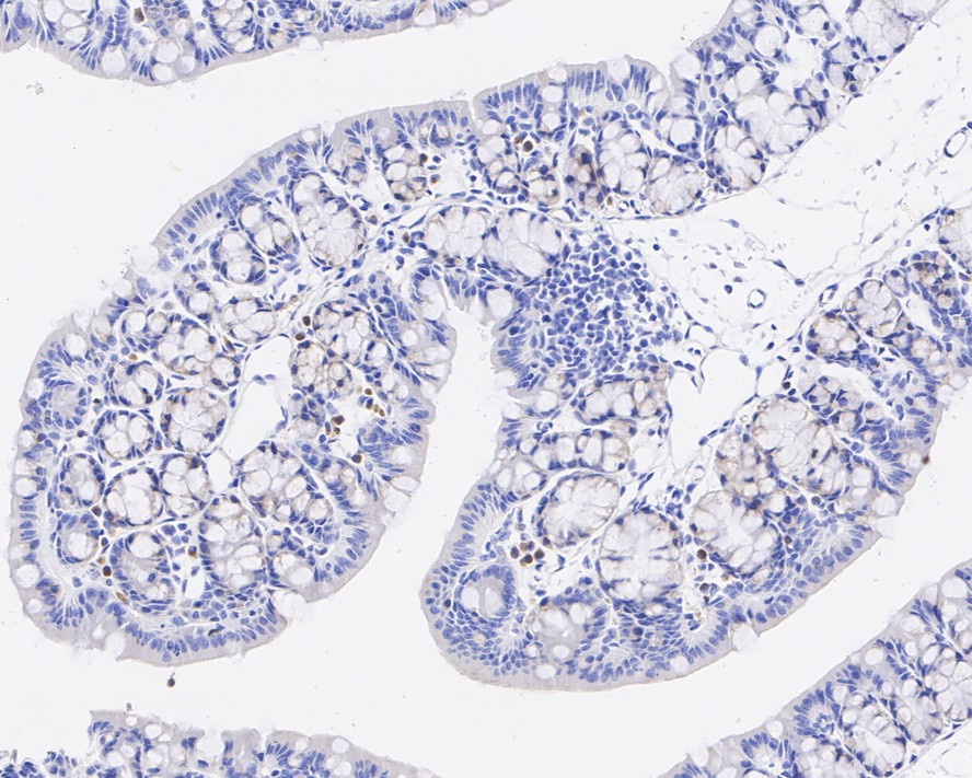 Immunohistochemical analysis of paraffin-embedded human lung tissue using anti-MCSF antibody. The section was pre-treated using heat mediated antigen retrieval with Tris-EDTA buffer (pH 8.0-8.4) for 20 minutes.The tissues were blocked in 5% BSA for 30 minutes at room temperature, washed with ddH2O and PBS, and then probed with the primary antibody (ET1609-1, 1/50) for 30 minutes at room temperature. The detection was performed using an HRP conjugated compact polymer system. DAB was used as the chromogen. Tissues were counterstained with hematoxylin and mounted with DPX.