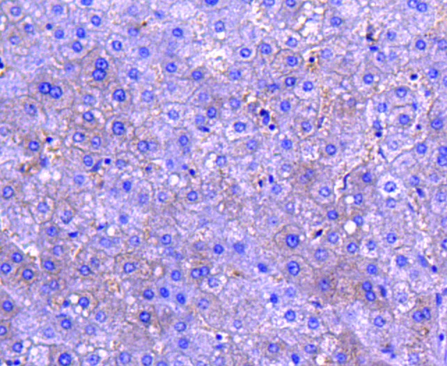 Immunohistochemical analysis of paraffin-embedded human kidney tissue with Rabbit anti-MCSF antibody (ET1609-1) at 1/100 dilution.<br />
<br />
The section was pre-treated using heat mediated antigen retrieval with Tris-EDTA buffer (pH 9.0) for 20 minutes. The tissues were blocked in 1% BSA for 20 minutes at room temperature, washed with ddH2O and PBS, and then probed with the primary antibody (ET1609-1) at 1/100 dilution for 1 hour at room temperature. The detection was performed using an HRP conjugated compact polymer system. DAB was used as the chromogen. Tissues were counterstained with hematoxylin and mounted with DPX.
