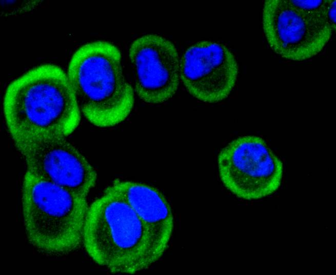 ICC staining YB1(1/50) in MCF-7 cells (green). The nuclear counter stain is DAPI (blue). Cells were fixed in paraformaldehyde, permeabilised with 0.25% Triton X100/PBS.