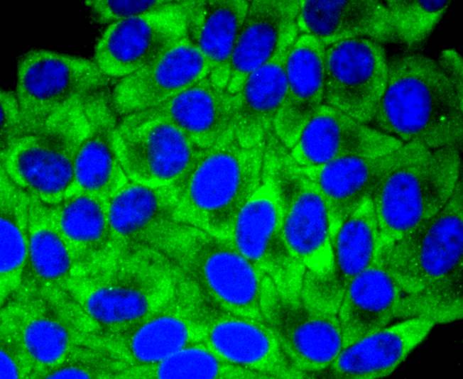 ICC staining YB1(1/50) in HepG2 cells (green). The nuclear counter stain is DAPI (blue). Cells were fixed in paraformaldehyde, permeabilised with 0.25% Triton X100/PBS.