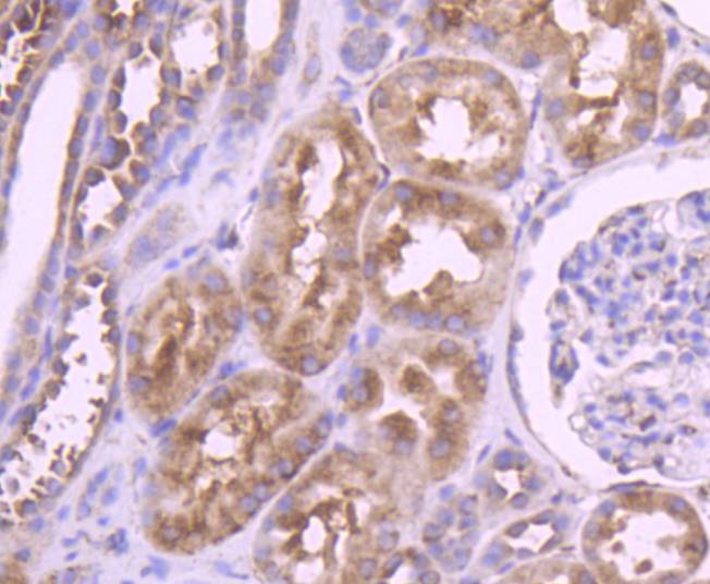 Immunohistochemical analysis of paraffin-embedded human kidney tissue using anti-YB1 antibody at 1/200. Counter stained with hematoxylin.