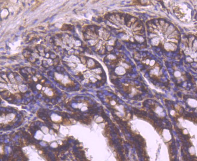 Immunohistochemical analysis of paraffin-embedded mouse colon tissue using anti-YB1 antibody at 1/200. Counter stained with hematoxylin.