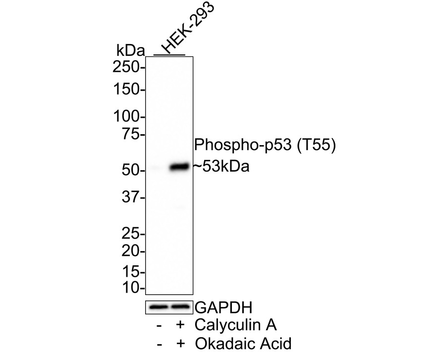 Western blot analysis of Phospho-p53 (T55) on human skin tissue lysates. Proteins were transferred to a PVDF membrane and blocked with 5% BSA in PBS for 1 hour at room temperature. The primary antibody (ET1609-13, 1/500) was used in 5% BSA at room temperature for 2 hours. Goat Anti-Rabbit IgG - HRP Secondary Antibody (HA1001) at 1:5,000 dilution was used for 1 hour at room temperature.