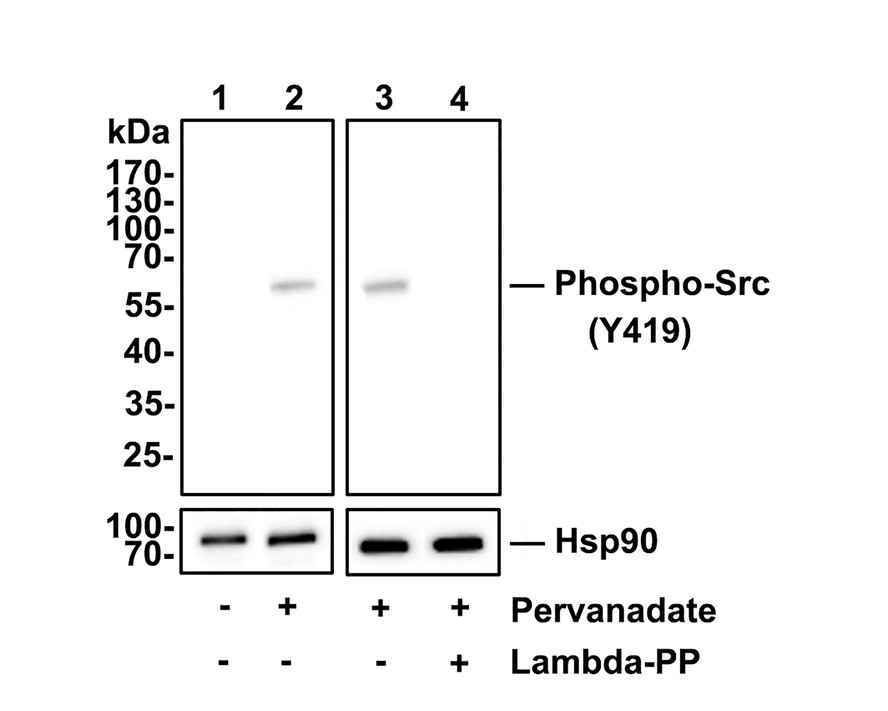 Western blot analysis of Phospho-Src(Y419) on HepG2 cell lysates.<br />
<br />
Lane 1: HepG2 cells, whole cell lysate, 10ug/lane<br />
Lane 2/3: HepG2 cells treated with 50 uM pervanadate for 10 minutes, whole cell lysates, 10ug/lane<br />
Lane 4: HepG2 cells treated with 50 uM pervanadate for 10 minutes, then treated with 2.8ug/ul lambda-PP for 30 minutes, whole cell lysates, 10ug/lane<br />
<br />
All lanes :<br />
Anti-Phospho-Src(Y419) antibody (ET1609-15) at 1/500 dilution. Anti-Hsp90 beta antibody (ET1605-56) at 1/10,000 dilution. Goat Anti-Rabbit IgG H&L (HRP) (HA1001) at 1/200,000 dilution.<br />
<br />
Predicted band size: 60 kDa<br />
Observed band size: 60 kDa<br />
<br />
Blocking and diluting buffer: 5% BSA.<br />
<br />
Exposure time: 30 seconds