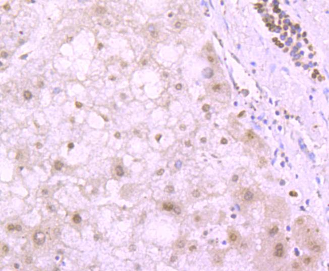 Immunohistochemical analysis of paraffin-embedded human liver tissue using anti-Histone H4 (tri methyl K20) antibody at 1/200. Counter stained with hematoxylin.