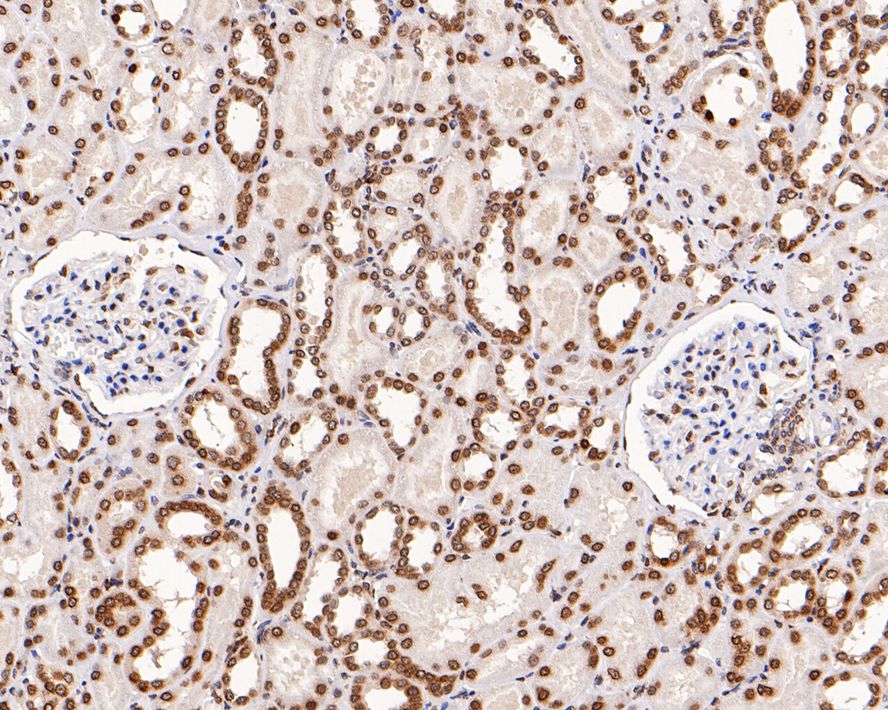 Immunohistochemical analysis of paraffin-embedded human kidney tissue with Rabbit anti-Histone H4 (tri methyl K20) antibody (ET1609-16) at 1/800 dilution.<br />
<br />
The section was pre-treated using heat mediated antigen retrieval with sodium citrate buffer (pH 6.0) for 2 minutes. The tissues were blocked in 1% BSA for 20 minutes at room temperature, washed with ddH2O and PBS, and then probed with the primary antibody (ET1609-16) at 1/800 dilution for 1 hour at room temperature. The detection was performed using an HRP conjugated compact polymer system. DAB was used as the chromogen. Tissues were counterstained with hematoxylin and mounted with DPX.