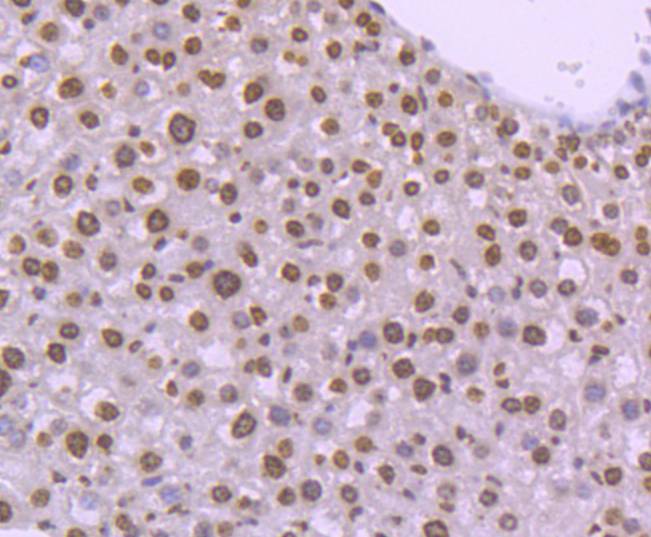 Immunohistochemical analysis of paraffin-embedded mouse liver tissue using anti-Histone H4 (tri methyl K20) antibody at 1/200. Counter stained with hematoxylin.