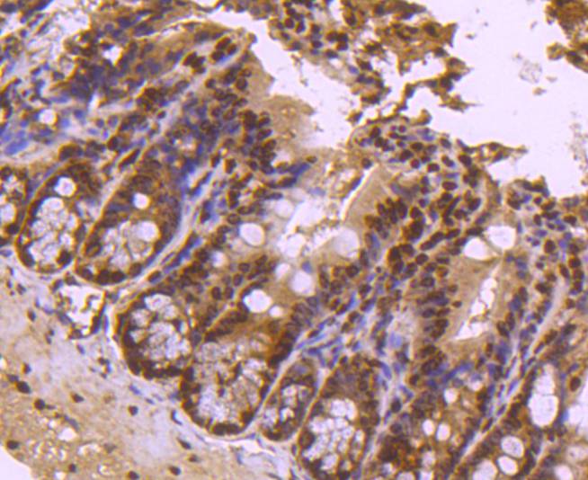 Immunohistochemical analysis of paraffin-embedded mouse colon tissue using anti-Histone H4 (tri methyl K20) antibody. Counter stained with hematoxylin.