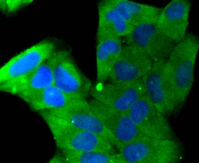 ICC staining Stathmin 1 (1/50) in Hela cells (green). The nuclear counter stain is DAPI (blue). Cells were fixed in paraformaldehyde, permeabilised with 0.25% Triton X100/PBS.