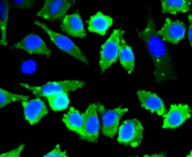 ICC staining Stathmin 1 (1/50) in SH-SY-5Y cells (green). The nuclear counter stain is DAPI (blue). Cells were fixed in paraformaldehyde, permeabilised with 0.25% Triton X100/PBS.