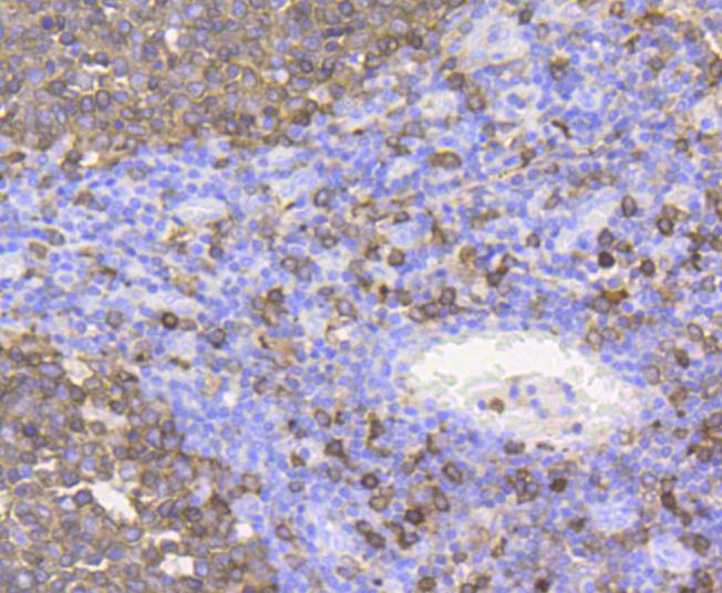 Immunohistochemical analysis of paraffin-embedded human tonsil tissue using anti-Stathmin 1 antibody at 1/200 dilution. Counter stained with hematoxylin.