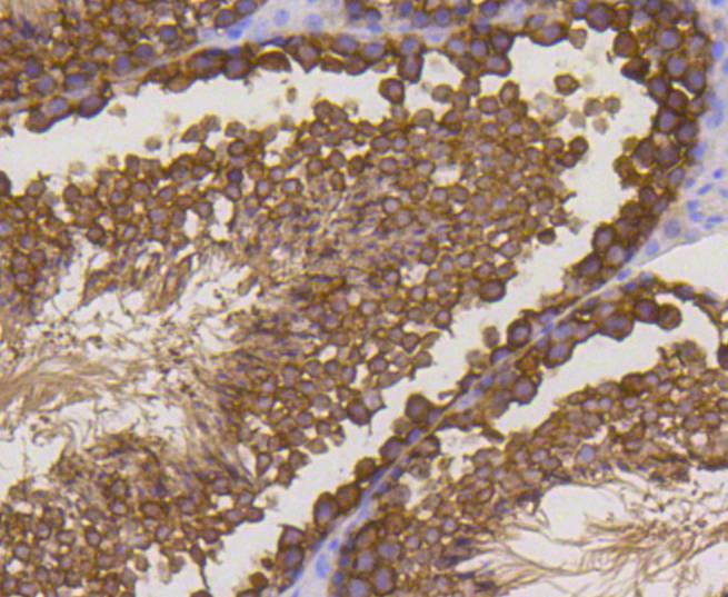 Immunohistochemical analysis of paraffin-embedded mouse testis tissue using anti-Stathmin 1 antibody at 1/200 dilution. Counter stained with hematoxylin.