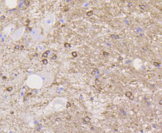 Immunohistochemical analysis of paraffin-embedded mouse spinal cord tissue using anti-Stathmin 1 antibody at 1/200 dilution. Counter stained with hematoxylin.