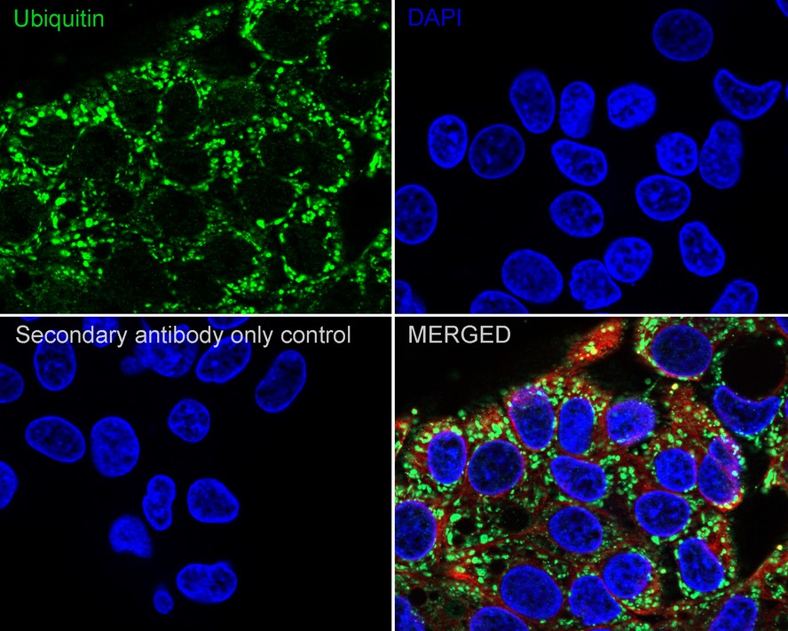 Immunocytochemistry analysis of HepG2 cells labeling Ubiquitin with Rabbit anti-Ubiquitin antibody (ET1609-21) at 1/500 dilution.<br />
<br />
Cells were fixed in 4% paraformaldehyde for 20 minutes at room temperature, permeabilized with 0.1% Triton X-100 in PBS for 5 minutes at room temperature, then blocked with 1% BSA in 10% negative goat serum for 1 hour at room temperature. Cells were then incubated with Rabbit anti-Ubiquitin antibody (ET1609-21) at 1/500 dilution in 1% BSA in PBST overnight at 4 ℃. Goat Anti-Rabbit IgG H&L (iFluor™ 488, HA1121) was used as the secondary antibody at 1/1,000 dilution. PBS instead of the primary antibody was used as the secondary antibody only control. Nuclear DNA was labelled in blue with DAPI.<br />
<br />
Beta tubulin (M1305-2, red) was stained at 1/100 dilution overnight at +4℃. Goat Anti-Mouse IgG H&L (iFluor™ 594, HA1126) was used as the secondary antibody at 1/1,000 dilution.