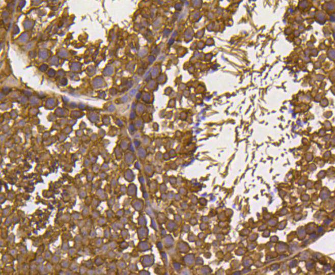 Immunohistochemical analysis of paraffin-embedded mouse testis tissue using anti-Ubiquitin antibody. The section was pre-treated using heat mediated antigen retrieval with Tris-EDTA buffer (pH 8.0-8.4) for 20 minutes.The tissues were blocked in 5% BSA for 30 minutes at room temperature, washed with ddH2O and PBS, and then probed with the primary antibody (ET1609-21, 1/50) for 30 minutes at room temperature. The detection was performed using an HRP conjugated compact polymer system. DAB was used as the chromogen. Tissues were counterstained with hematoxylin and mounted with DPX.