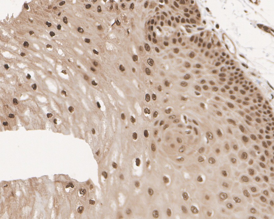 Immunohistochemical analysis of paraffin-embedded mouse placenta tissue using anti-Ubiquitin antibody. The section was pre-treated using heat mediated antigen retrieval with Tris-EDTA buffer (pH 8.0-8.4) for 20 minutes.The tissues were blocked in 5% BSA for 30 minutes at room temperature, washed with ddH2O and PBS, and then probed with the primary antibody (ET1609-21, 1/50) for 30 minutes at room temperature. The detection was performed using an HRP conjugated compact polymer system. DAB was used as the chromogen. Tissues were counterstained with hematoxylin and mounted with DPX.