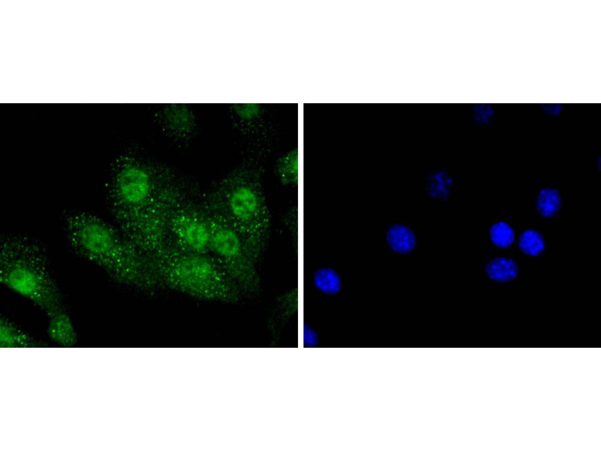ICC staining of Aurora A in NIH/3T3 cells (green). Formalin fixed cells were permeabilized with 0.1% Triton X-100 in TBS for 10 minutes at room temperature and blocked with 1% Blocker BSA for 15 minutes at room temperature. Cells were probed with the primary antibody (ET1609-22, 1/50) for 1 hour at room temperature, washed with PBS. Alexa Fluor®488 Goat anti-Rabbit IgG was used as the secondary antibody at 1/1,000 dilution. The nuclear counter stain is DAPI (blue).