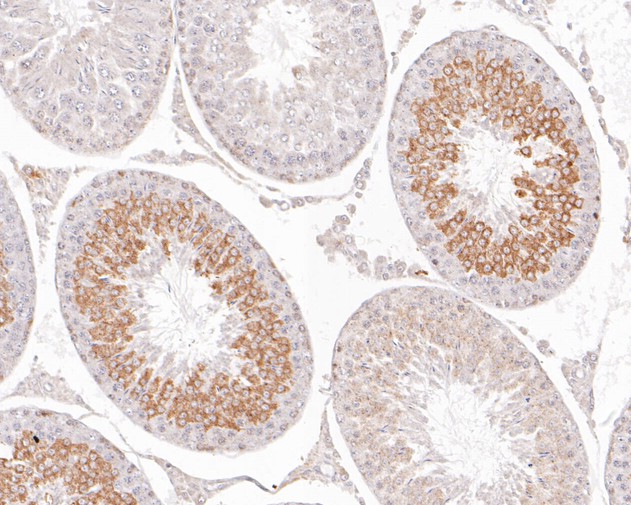 Immunohistochemical analysis of paraffin-embedded rat testis tissue using anti-Aurora A antibody. The section was pre-treated using heat mediated antigen retrieval with Tris-EDTA buffer (pH 8.0-8.4) for 20 minutes.The tissues were blocked in 5% BSA for 30 minutes at room temperature, washed with ddH2O and PBS, and then probed with the primary antibody (ET1609-22, 1/200) for 30 minutes at room temperature. The detection was performed using an HRP conjugated compact polymer system. DAB was used as the chromogen. Tissues were counterstained with hematoxylin and mounted with DPX.
