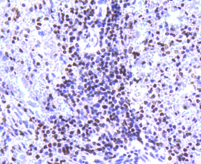 Immunohistochemical analysis of paraffin-embedded human spleen tissue using anti-Histone H2A.Z antibody. The section was pre-treated using heat mediated antigen retrieval with Tris-EDTA buffer (pH 8.0-8.4) for 20 minutes.The tissues were blocked in 5% BSA for 30 minutes at room temperature, washed with ddH2O and PBS, and then probed with the primary antibody (ET1609-23, 1/50) for 30 minutes at room temperature. The detection was performed using an HRP conjugated compact polymer system. DAB was used as the chromogen. Tissues were counterstained with hematoxylin and mounted with DPX.