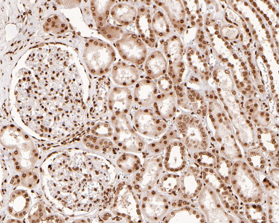Immunohistochemical analysis of paraffin-embedded human kidney tissue with Rabbit anti-Histone H2A.Z antibody (ET1609-23) at 1/200 dilution.<br />
<br />
The section was pre-treated using heat mediated antigen retrieval with sodium citrate buffer (pH 6.0) for 2 minutes. The tissues were blocked in 1% BSA for 20 minutes at room temperature, washed with ddH2O and PBS, and then probed with the primary antibody (ET1609-23) at 1/200 dilution for 1 hour at room temperature. The detection was performed using an HRP conjugated compact polymer system. DAB was used as the chromogen. Tissues were counterstained with hematoxylin and mounted with DPX.