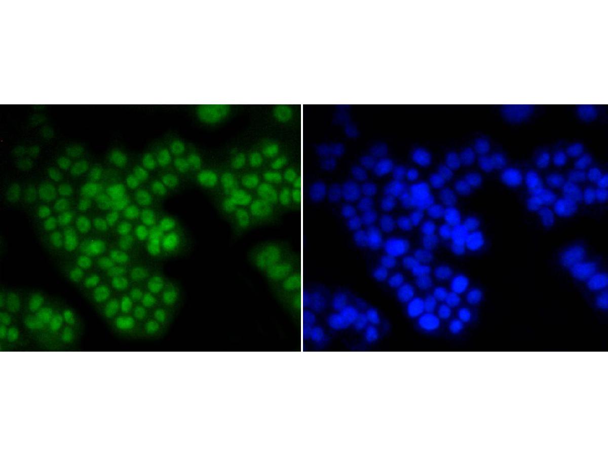ICC staining ASH2L (1/500) in PC12 cells (green). The nuclear counter stain is DAPI (blue). Cells were fixed in paraformaldehyde, permeabilised with 0.25% Triton X100/PBS.