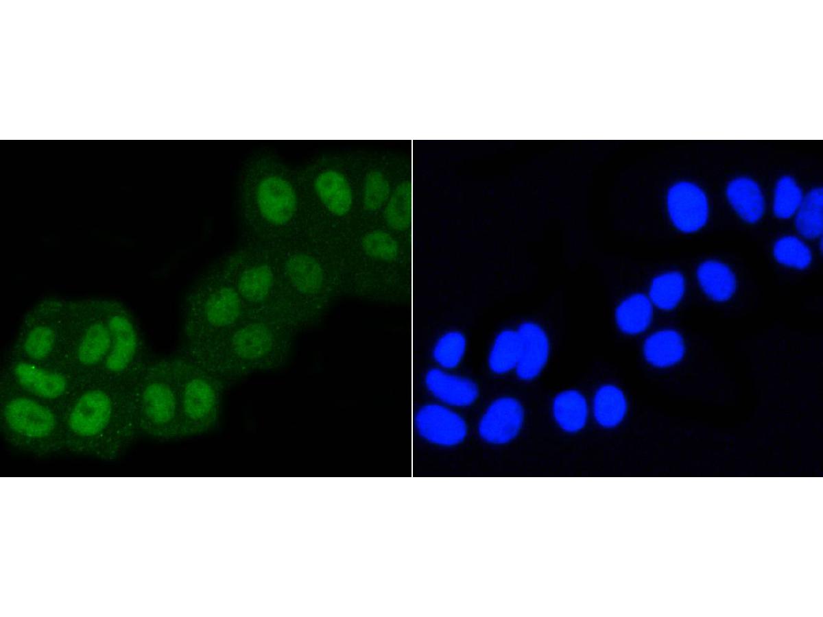 ICC staining ASH2L (1/500) in MCF-7 cells (green). The nuclear counter stain is DAPI (blue). Cells were fixed in paraformaldehyde, permeabilised with 0.25% Triton X100/PBS.
