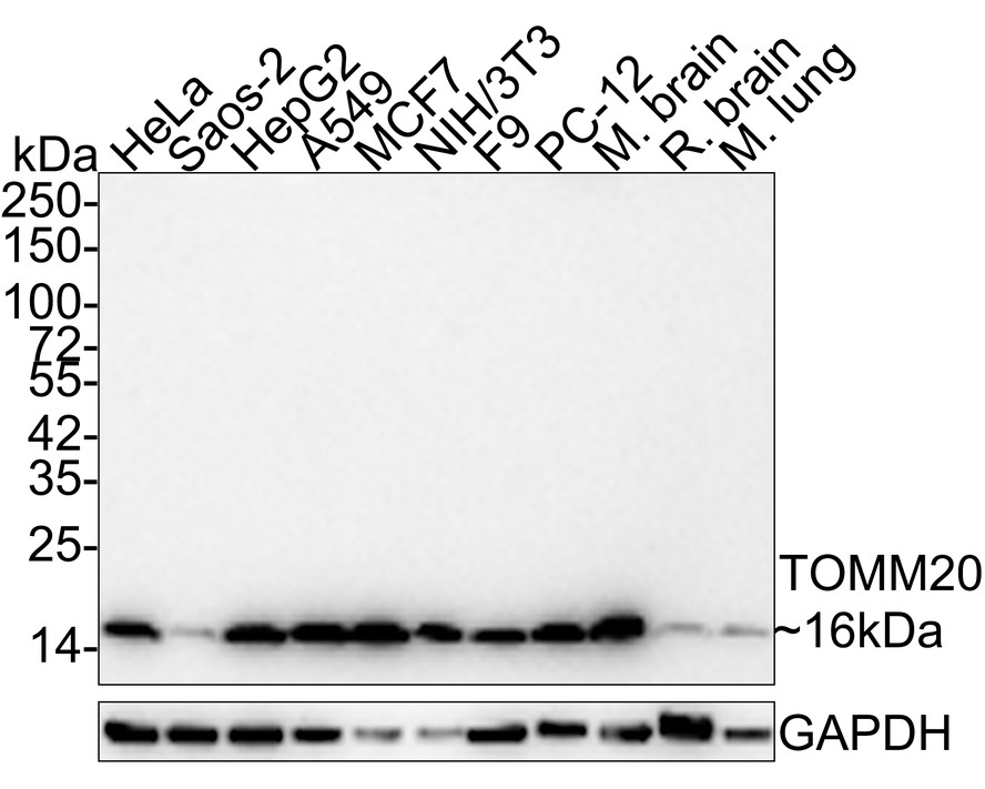 Western blot analysis of TOMM20 on different lysates with Rabbit anti-TOMM20 antibody (ET1609-25) at 1/2,000 dilution.<br />
<br />
Lane 1: HeLa cell lysate (10 µg/Lane)<br />
Lane 2: Saos-2 cell lysate (10 µg/Lane)<br />
Lane 3: HepG2 cell lysate (10 µg/Lane)<br />
Lane 4: A549 cell lysate (10 µg/Lane)<br />
Lane 5: MCF7 cell lysate (10 µg/Lane)<br />
Lane 6: NIH/3T3 cell lysate (10 µg/Lane)<br />
Lane 7: F9 cell lysate (10 µg/Lane)<br />
Lane 8: PC-12 cell lysate (10 µg/Lane)<br />
Lane 9: Mouse brain tissue lysate (20 µg/Lane)<br />
Lane 10: Rat brain tissue lysate (20 µg/Lane)<br />
Lane 11: Rat lung tissue lysate (20 µg/Lane)<br />
<br />
Predicted band size: 16 kDa<br />
Observed band size: 16 kDa<br />
<br />
Exposure time: 1 minute 22 seconds;<br />
<br />
4-20% SDS-PAGE gel.<br />
<br />
Proteins were transferred to a PVDF membrane and blocked with 5% NFDM/TBST for 1 hour at room temperature. The primary antibody (ET1609-25) at 1/2,000 dilution was used in 5% NFDM/TBST at room temperature for 2 hours. Goat Anti-Rabbit IgG - HRP Secondary Antibody (HA1001) at 1:100,000 dilution was used for 1 hour at room temperature.
