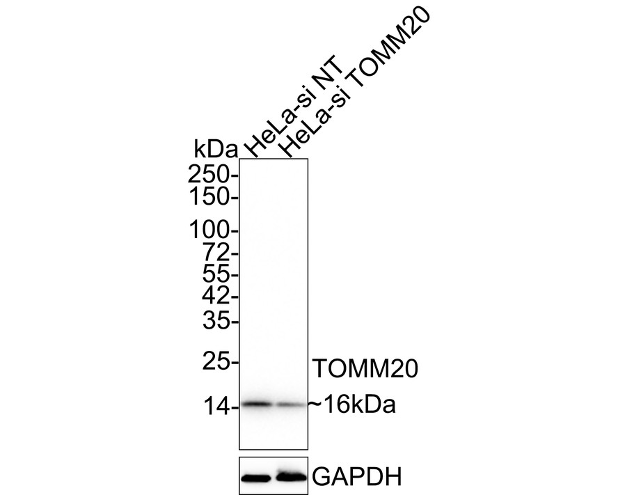 Western blot analysis of TOMM20 on different lysates with Rabbit anti-TOMM20 antibody (ET1609-25) at 1/5,000 dilution.<br />
<br />
Lane 1: HeLa-si NT cell lysate<br />
Lane 2: HeLa-si TOMM20 cell lysate<br />
<br />
Lysates/proteins at 10 µg/Lane.<br />
<br />
Predicted band size: 16 kDa<br />
Observed band size: 16 kDa<br />
<br />
Exposure time: 21 seconds;<br />
<br />
4-20% SDS-PAGE gel.<br />
<br />
Proteins were transferred to a PVDF membrane and blocked with 5% NFDM/TBST for 1 hour at room temperature. The primary antibody (ET1609-25) at 1/5,000 dilution was used in 5% NFDM/TBST at 4℃ overnight. Goat Anti-Rabbit IgG - HRP Secondary Antibody (HA1001) at 1/50,000 dilution was used for 1 hour at room temperature.