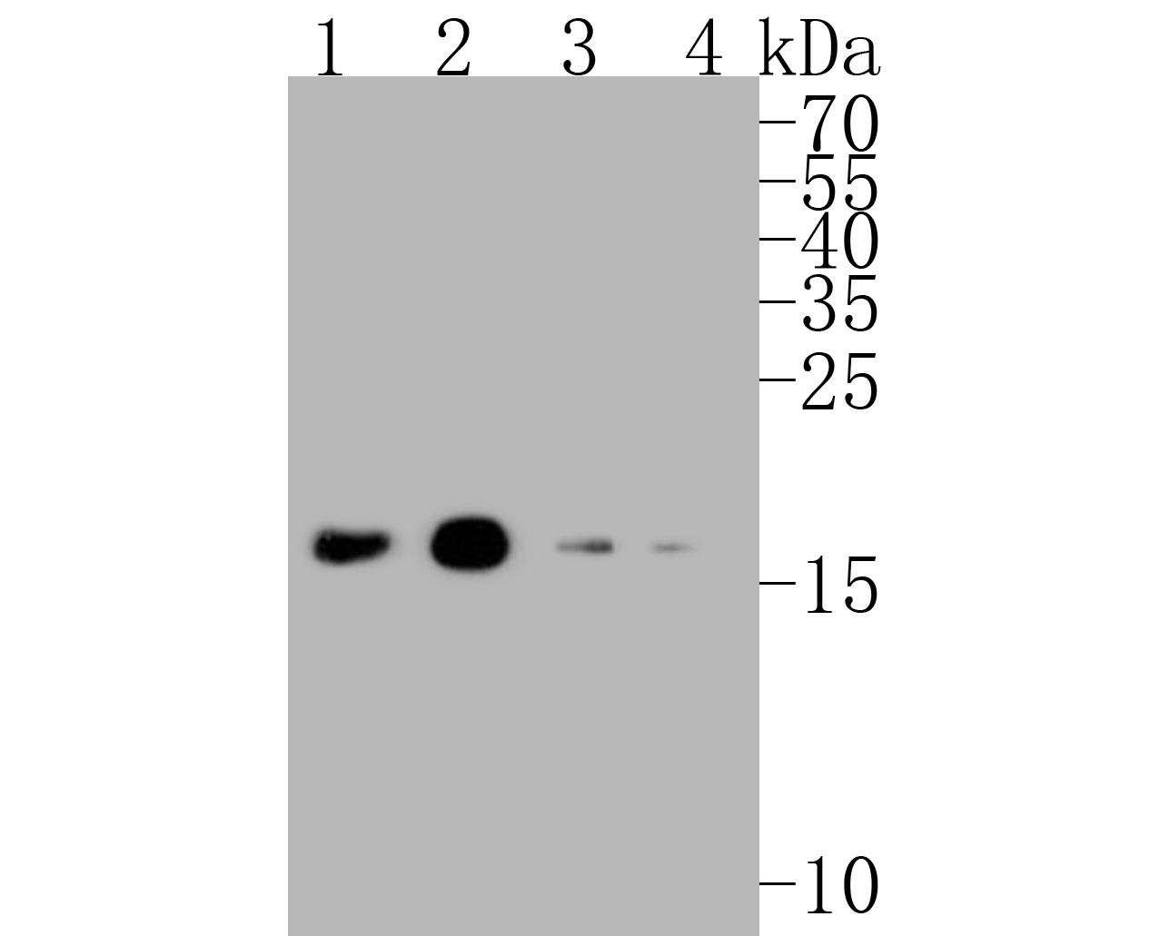 Immunocytochemistry analysis of SH-SY5Y cells labeling MAP1LC3A with Rabbit anti-MAP1LC3A antibody (ET1609-26) at 1/200 dilution.<br />
<br />
Cells were fixed in 4% paraformaldehyde for 10 minutes at 37 ℃, permeabilized with 0.05% Triton X-100 in PBS for 20 minutes, and then blocked with 2% negative goat serum for 30 minutes at room temperature. Cells were then incubated with Rabbit anti-MAP1LC3A antibody (ET1609-26) at 1/200 dilution in 2% negative goat serum overnight at 4 ℃. Goat Anti-Rabbit IgG H&L (iFluor™ 488, HA1121) was used as the secondary antibody at 1/1,000 dilution. Nuclear DNA was labelled in blue with DAPI.<br />
<br />
Beta tubulin (M1305-2, red) was stained at 1/100 dilution overnight at +4℃. Goat Anti-Mouse IgG H&L (iFluor™ 594, HA1126) was used as the secondary antibody at 1/1,000 dilution.