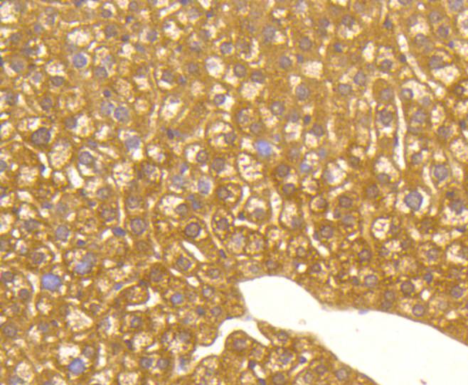 Immunohistochemical analysis of paraffin-embedded mouse liver tissue using anti-MAP1LC3A antibody. The section was pre-treated using heat mediated antigen retrieval with Tris-EDTA buffer (pH 8.0-8.4) for 20 minutes.The tissues were blocked in 5% BSA for 30 minutes at room temperature, washed with ddH2O and PBS, and then probed with the primary antibody (ET1609-26, 1/50) for 30 minutes at room temperature. The detection was performed using an HRP conjugated compact polymer system. DAB was used as the chromogen. Tissues were counterstained with hematoxylin and mounted with DPX.