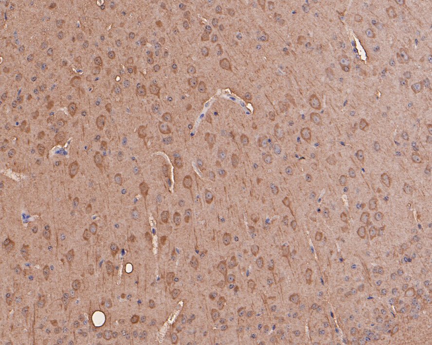 Immunohistochemical analysis of paraffin-embedded mouse brain tissue with Rabbit anti-MAP1LC3A antibody (ET1609-26) at 1/200 dilution.<br />
<br />
The section was pre-treated using heat mediated antigen retrieval with Tris-EDTA buffer (pH 9.0) for 20 minutes. The tissues were blocked in 1% BSA for 20 minutes at room temperature, washed with ddH2O and PBS, and then probed with the primary antibody (ET1609-26) at 1/200 dilution for 1 hour at room temperature. The detection was performed using an HRP conjugated compact polymer system. DAB was used as the chromogen. Tissues were counterstained with hematoxylin and mounted with DPX.