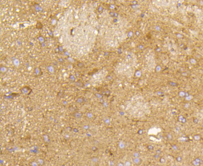 Immunohistochemical analysis of paraffin-embedded mouse brain tissue with Rabbit anti-Rab5 antibody (ET1609-27) at 1/50 dilution.<br />
<br />
The section was pre-treated using heat mediated antigen retrieval with Tris-EDTA buffer (pH 9.0) for 20 minutes. The tissues were blocked in 1% BSA for 20 minutes at room temperature, washed with ddH2O and PBS, and then probed with the primary antibody (ET1609-27) at 1/50 dilution for 1 hour at room temperature. The detection was performed using an HRP conjugated compact polymer system. DAB was used as the chromogen. Tissues were counterstained with hematoxylin and mounted with DPX.