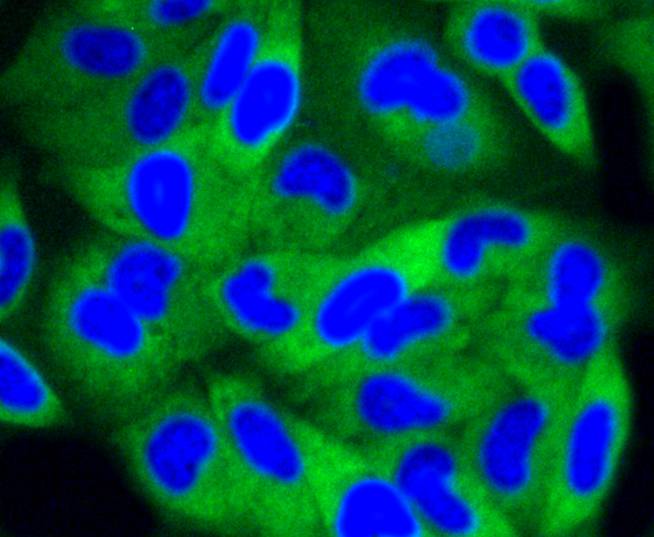 ICC staining of PI 3 Kinase p85 beta in Hela cells (green). Formalin fixed cells were permeabilized with 0.1% Triton X-100 in TBS for 10 minutes at room temperature and blocked with 10% negative goat serum for 15 minutes at room temperature. Cells were probed with the primary antibody (ET1609-30, 1/50) for 1 hour at room temperature, washed with PBS. Alexa Fluor®488 conjugate-Goat anti-Rabbit IgG was used as the secondary antibody at 1/1,000 dilution. The nuclear counter stain is DAPI (blue).